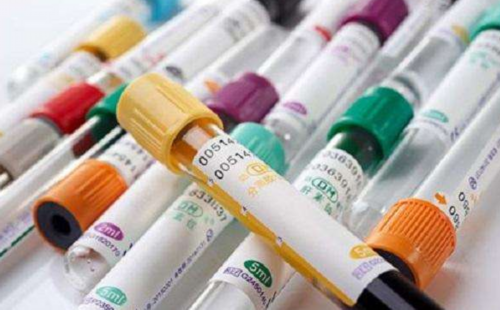 子宫肌瘤如何消除