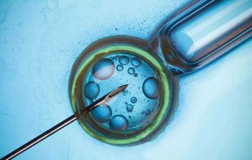 单身女国外做试管_国内试管包生男孩,什么是染色体疾病的植入前胚胎遗传学检