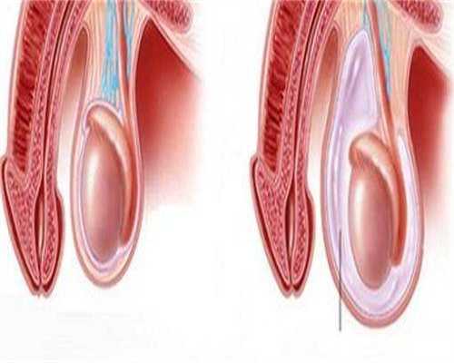 异种移植最新突破:
