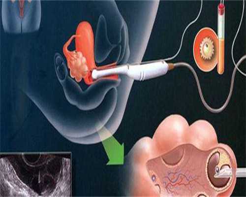 南昌供卵试管中心费用，南昌可以做供卵试管的医院有哪些？南昌供卵试管医院