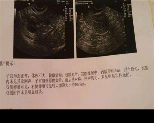 有正规代孕的机构吗_四川试管婴儿包成功,多久可以测出怀孕?大姨妈月经停经